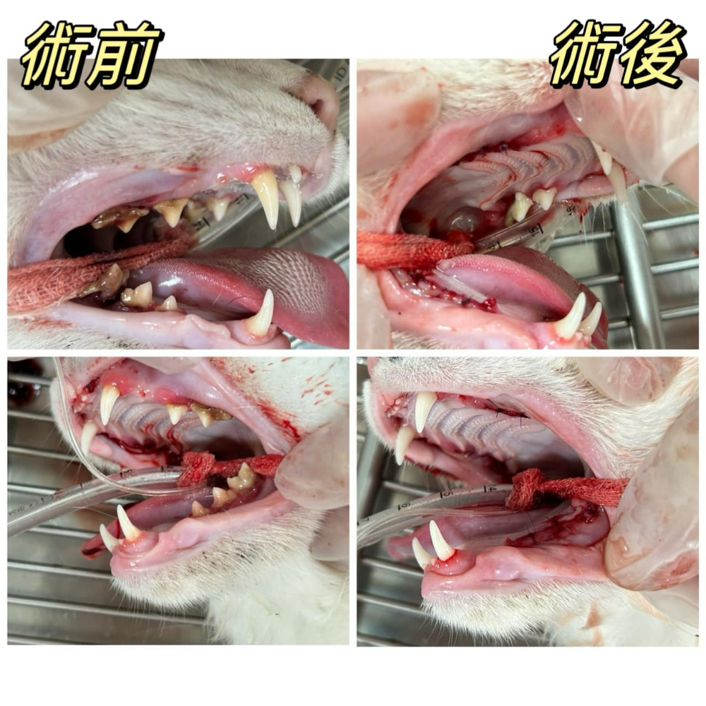 《青少年齒齦炎》