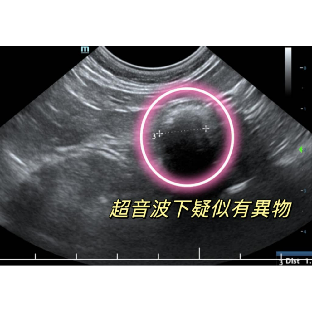 什麼是毛球症?